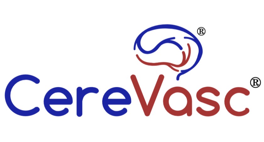 Enrollment Complete in CereVasc’s eShunt System Trial
